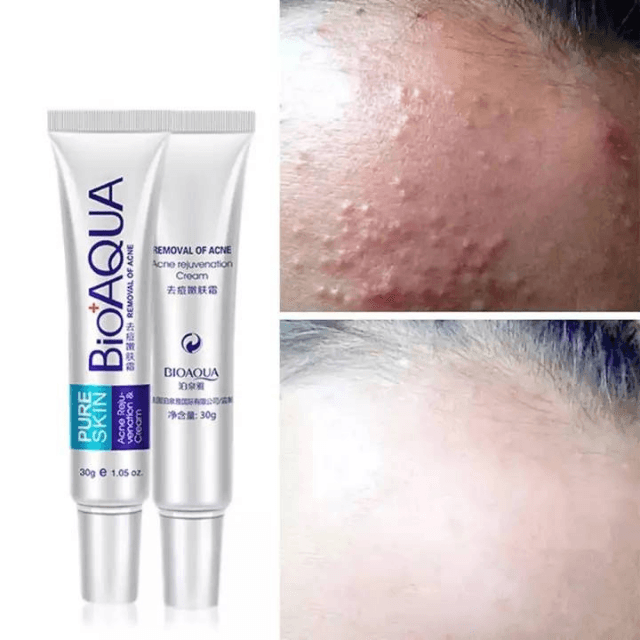 BioAqua acne Removal Cream